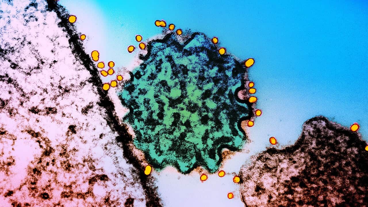 Nipah virus particle