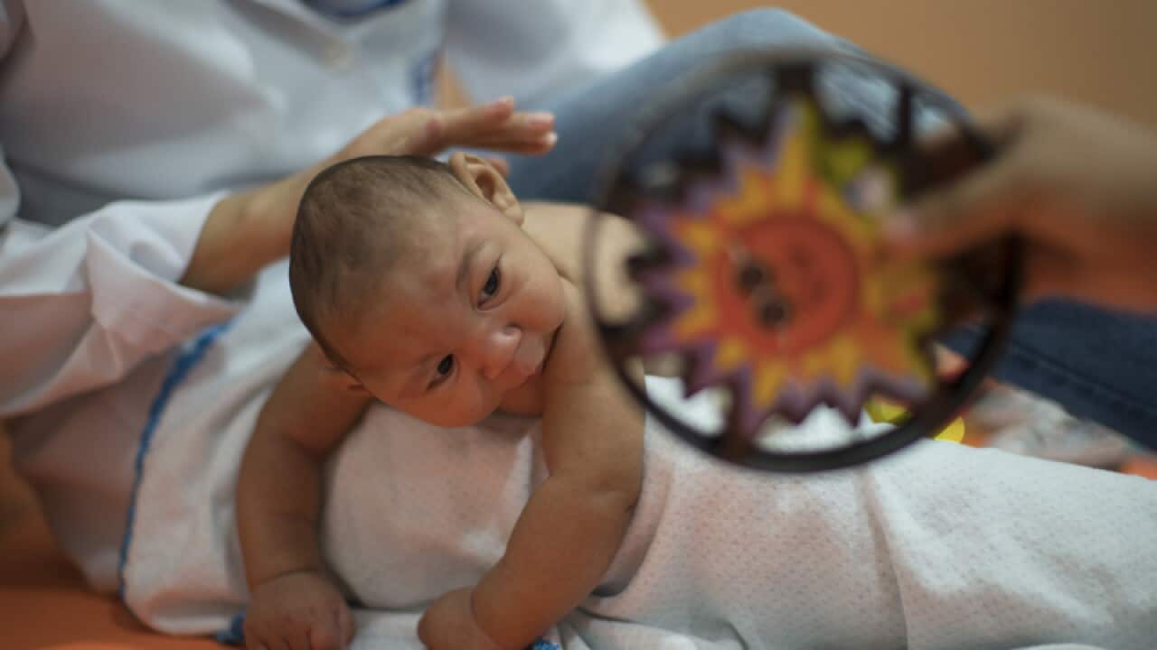 Three-month-old Daniel, who was born with microcephaly