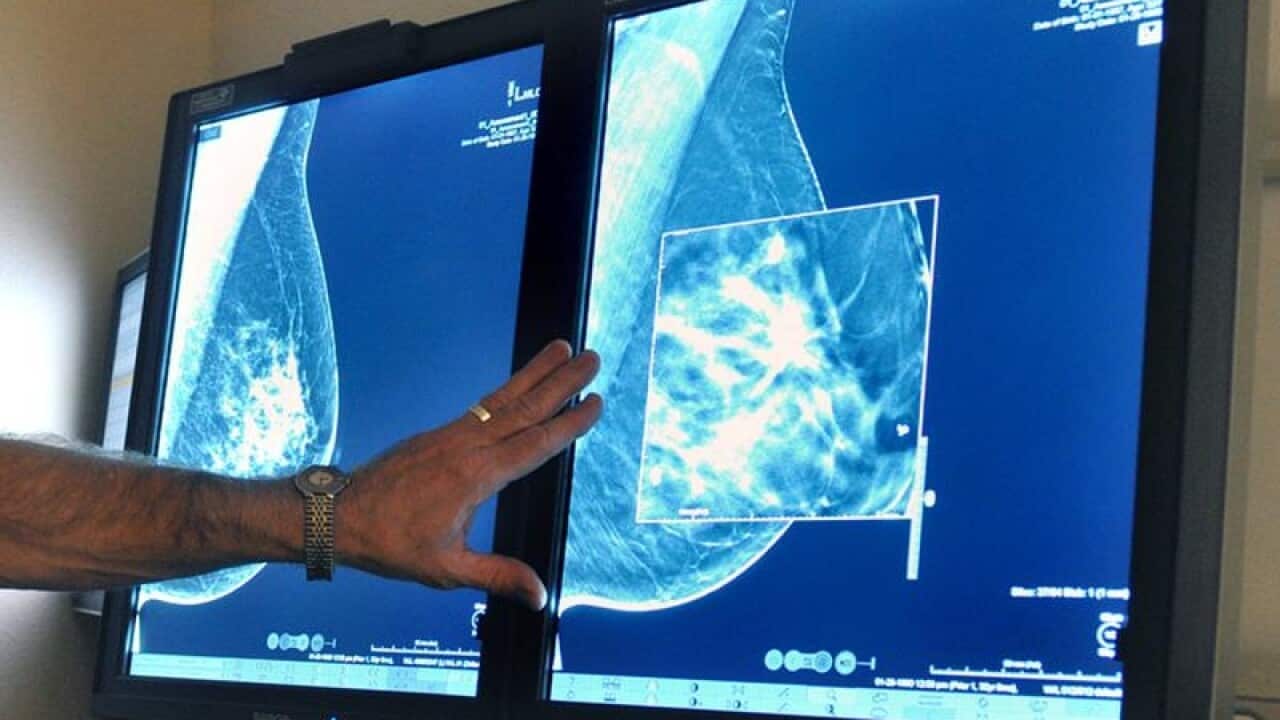 Mammogram breast cancer