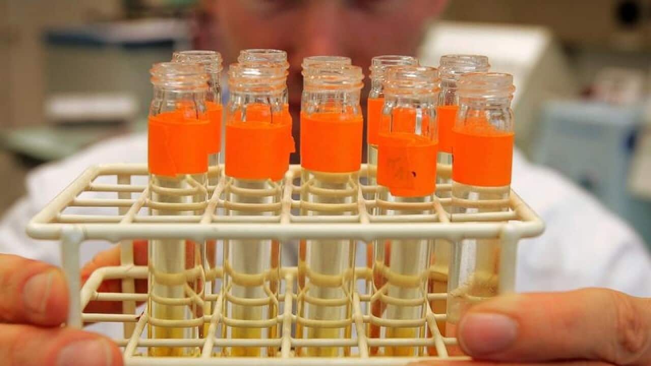 urine samples