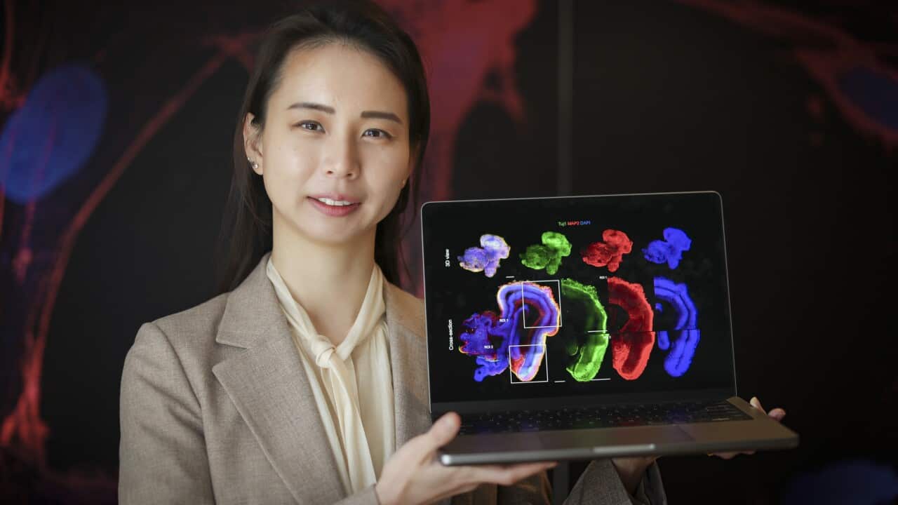 Image for read more article ''