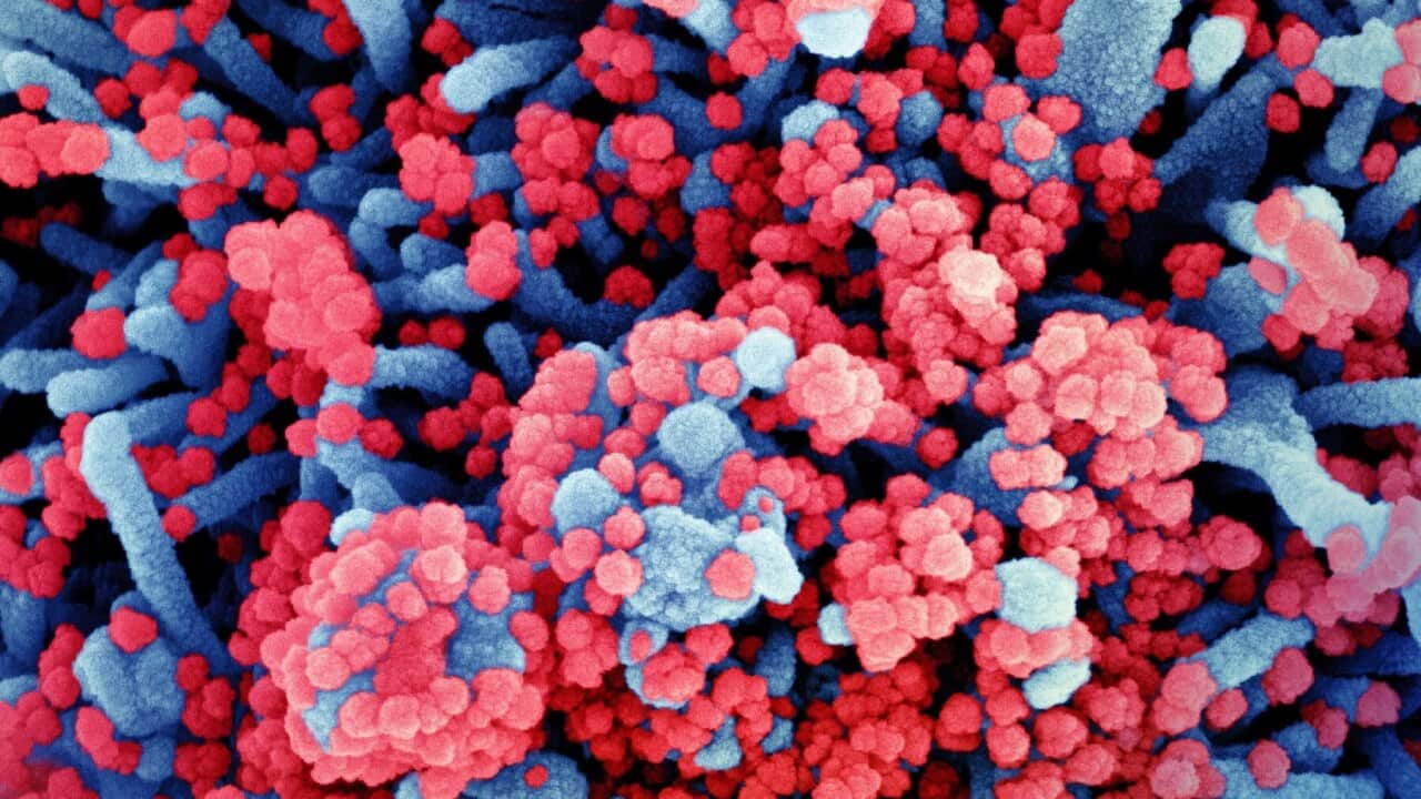 Colourised scanning electron micrograph of a cell (blue) heavily infected with coronavirus particles (red)