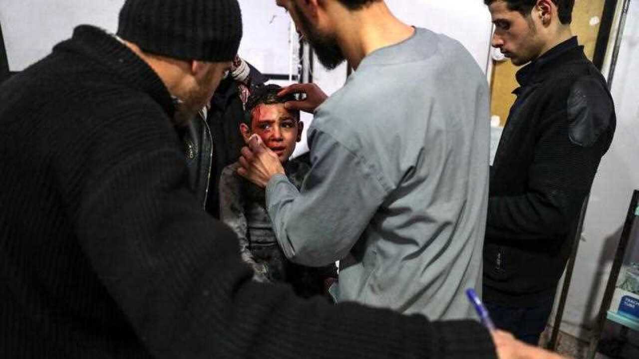 A nurse asks an injured child about his father as another treats him inside a hospital after bombing, rebels-held Douma, Eastern Ghouta, 22 February 2018