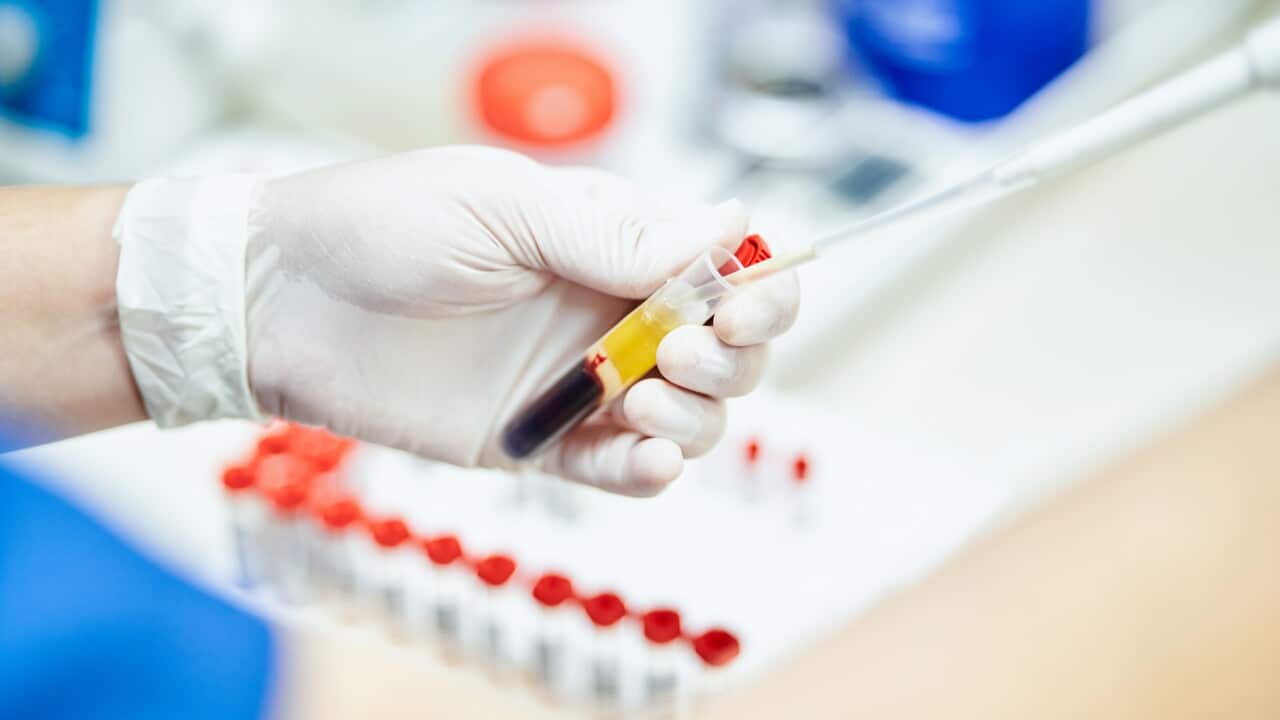 Pipette taking samples from a tube in an analysis laboratory.