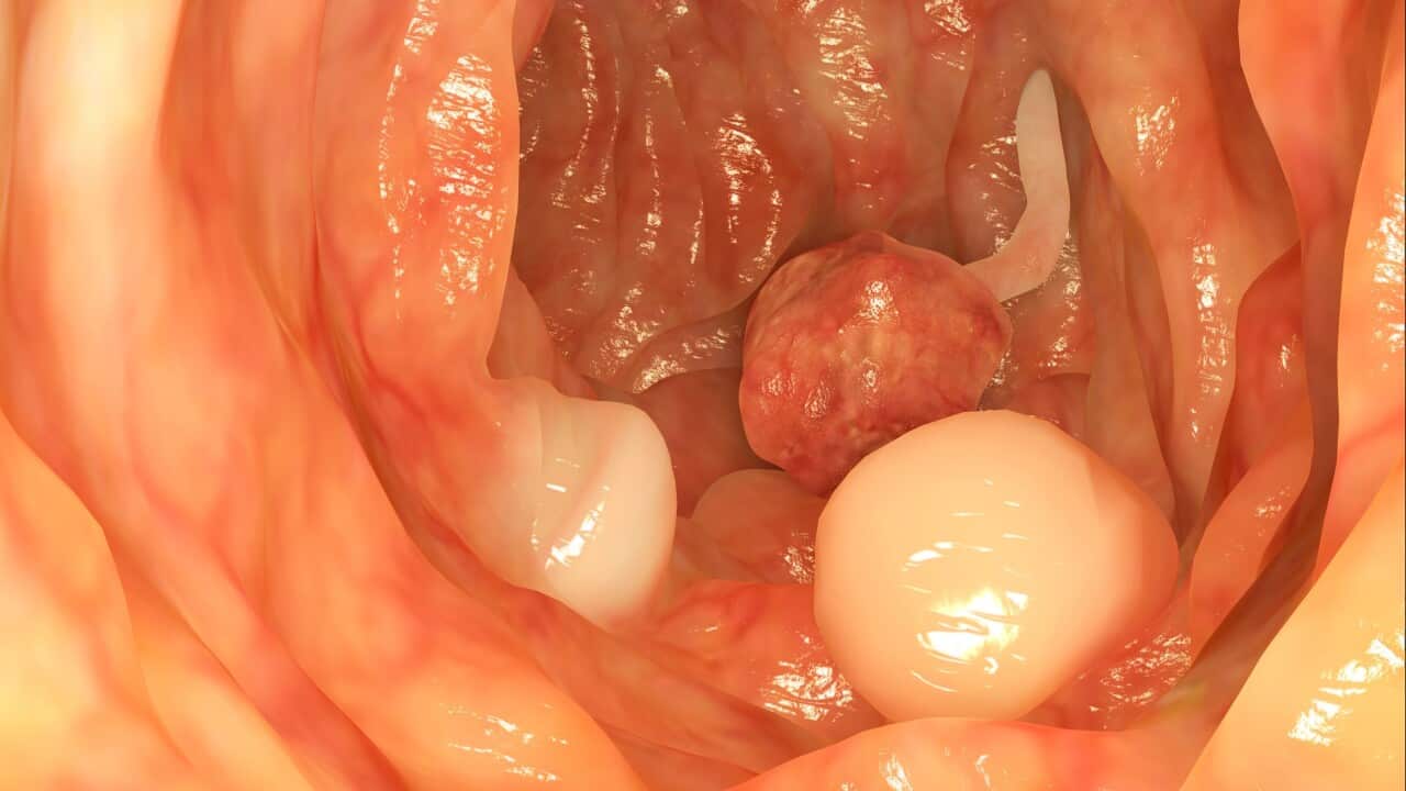 Image for read more article 'READ MORE'