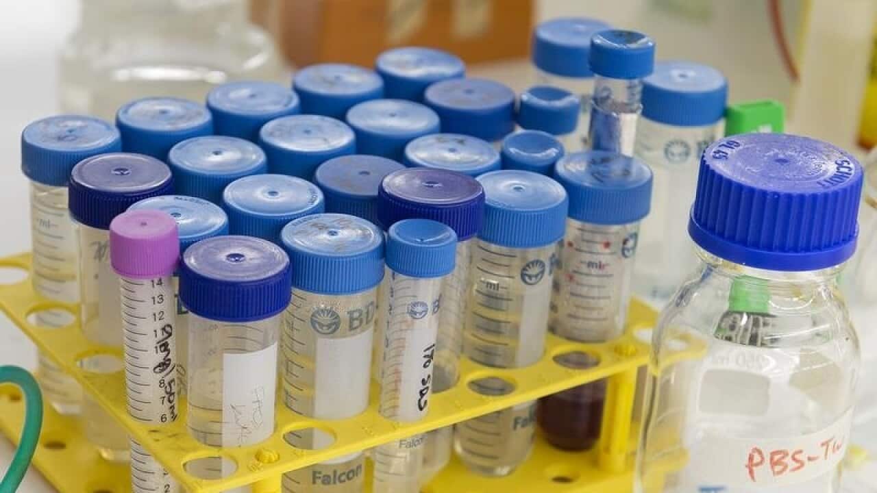 A stock image of test tubes in a medical laboratory
