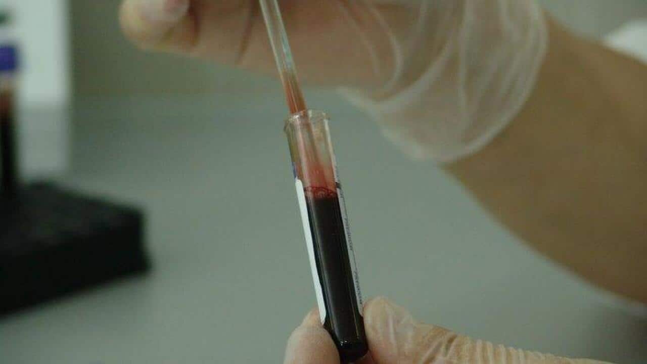 Blood Testing