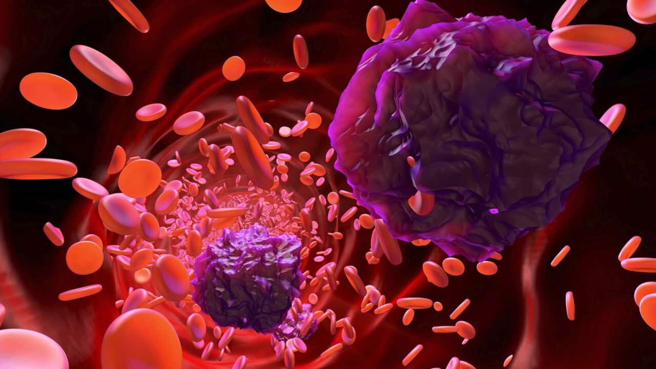 3D rendered Illustration of Leukaemia cells in the blood stream (Getty).