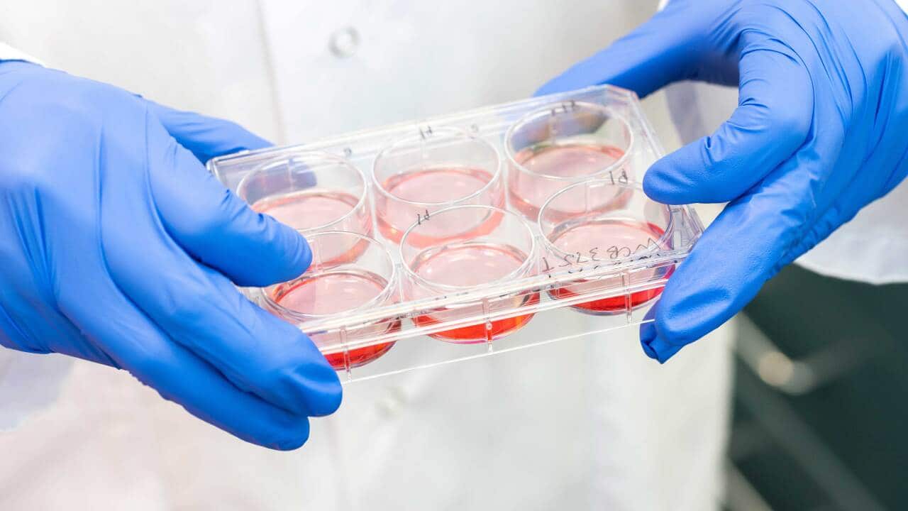 bowel cancer tray.jpg