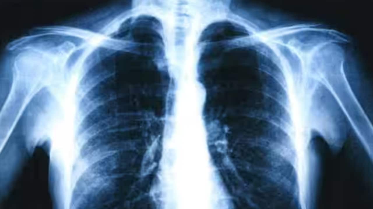 Image for read more article '阅读更多'