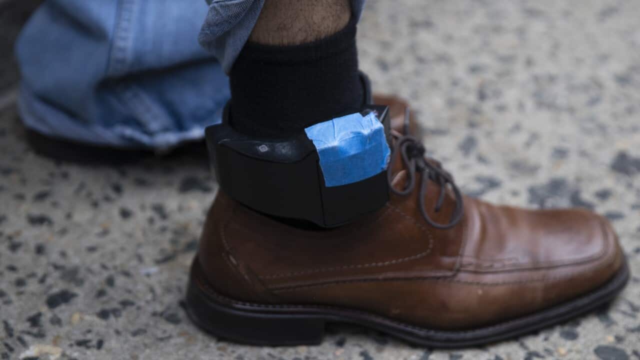 A close up of a monitor attached to a person's ankle.
