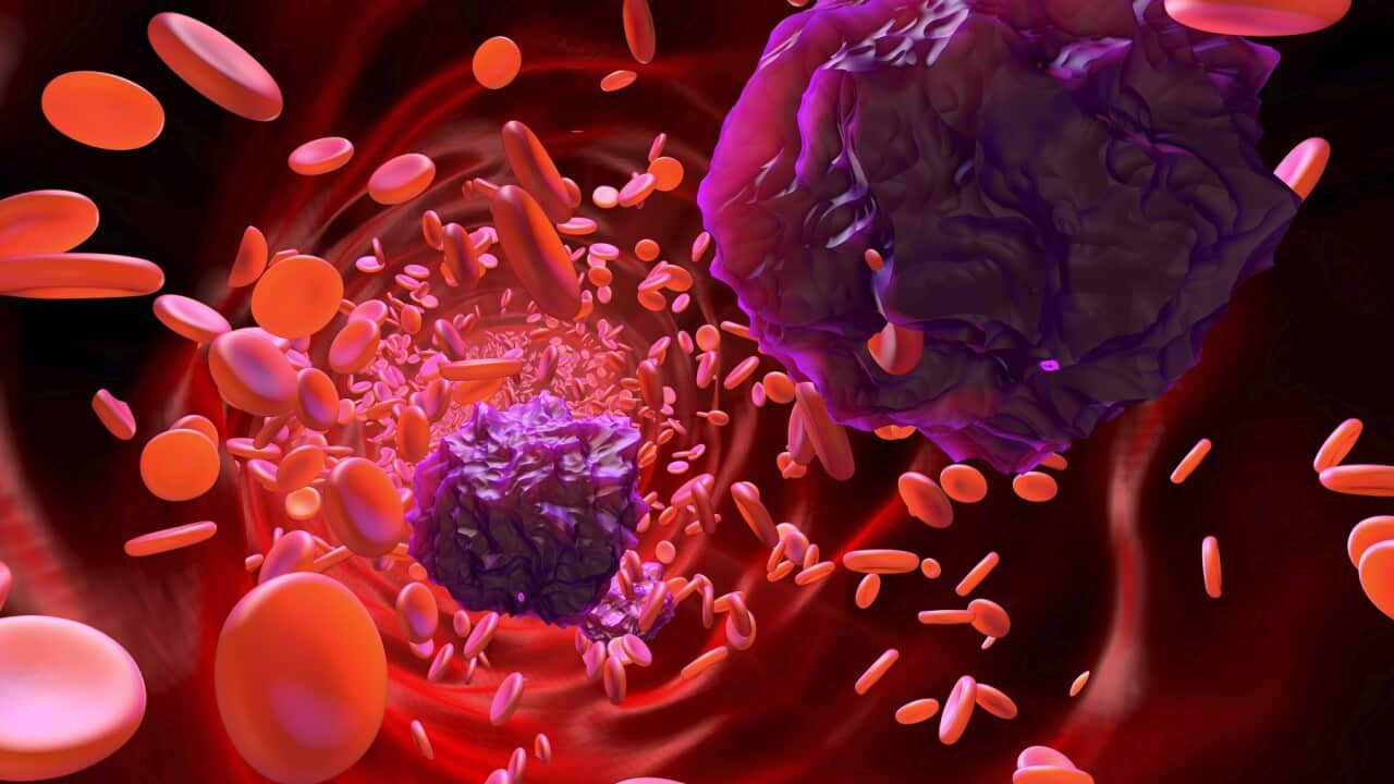 3D rendered Illustration of Leukemia cells in the blood stream
