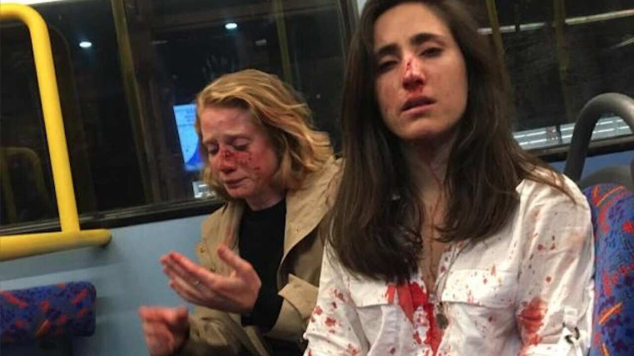 Ataque homofóbico contra uruguaya y su pareja estadounidense
