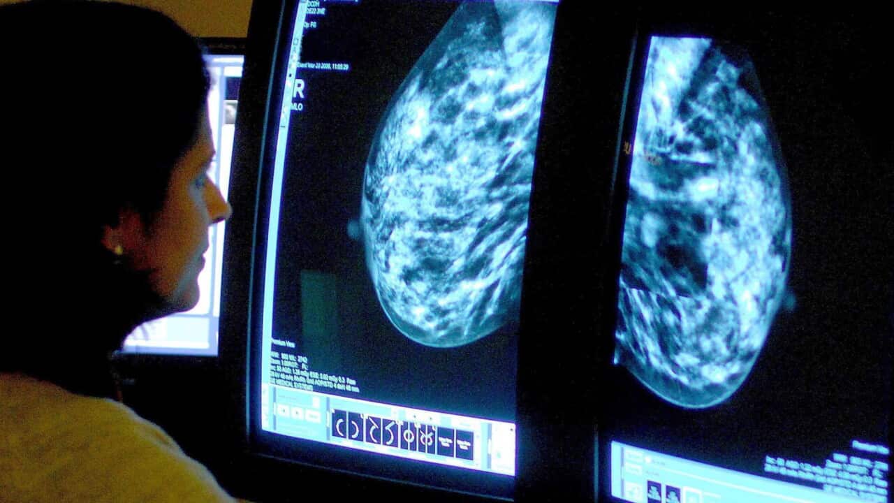 Mammogram image