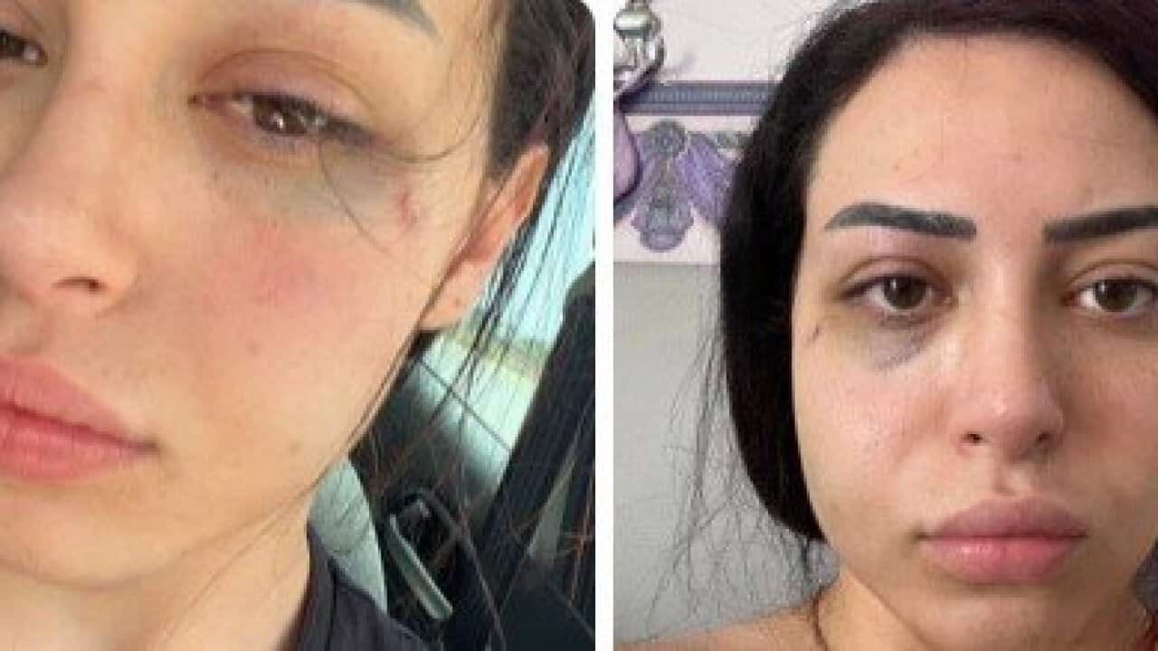 Image for read more article 'READ MORE'