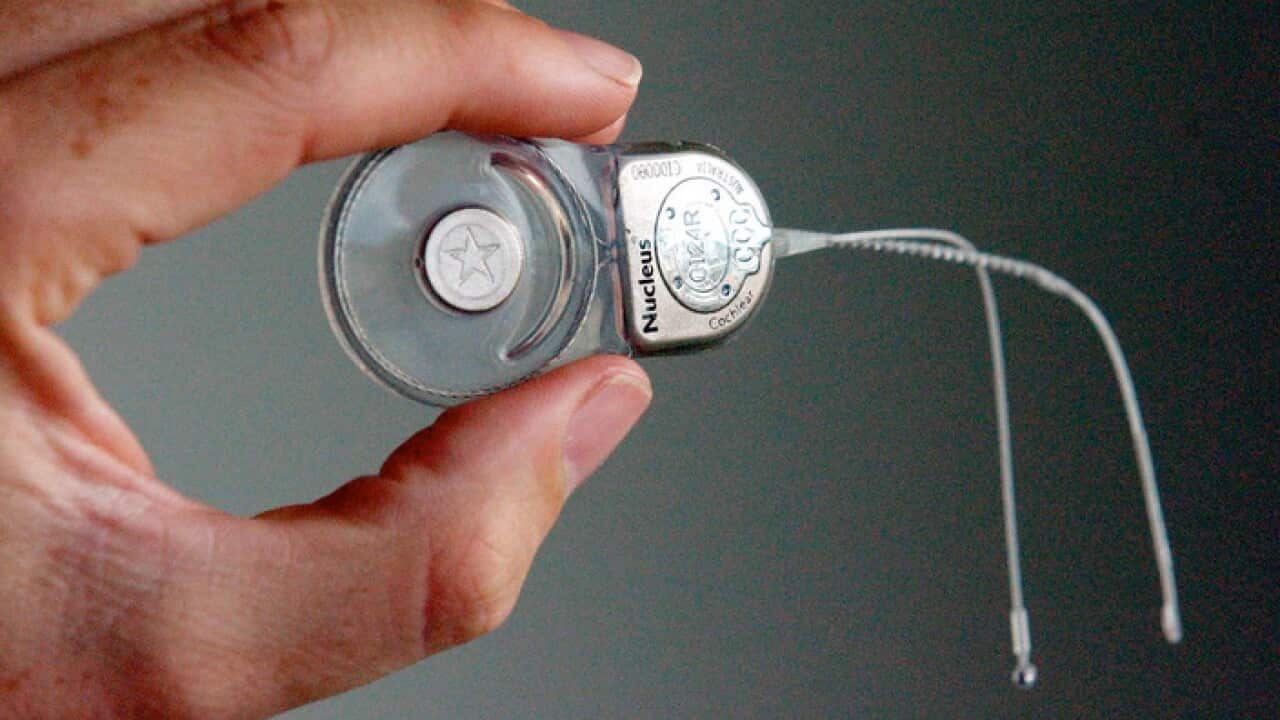 An April 23, 2002 file photo of a Cochlear implant which is inserted into the ear of a deaf patient, Sydney. Cochlear are celebrating the 30th anniversary of their first implant back in 1982.(AAP Image/Dan Peled) NO ARCHIVING