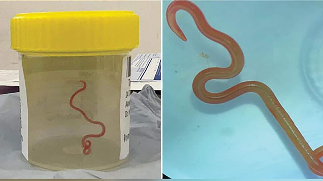 AUSTRALIA PARASITIC INFECTION DISCOVERY