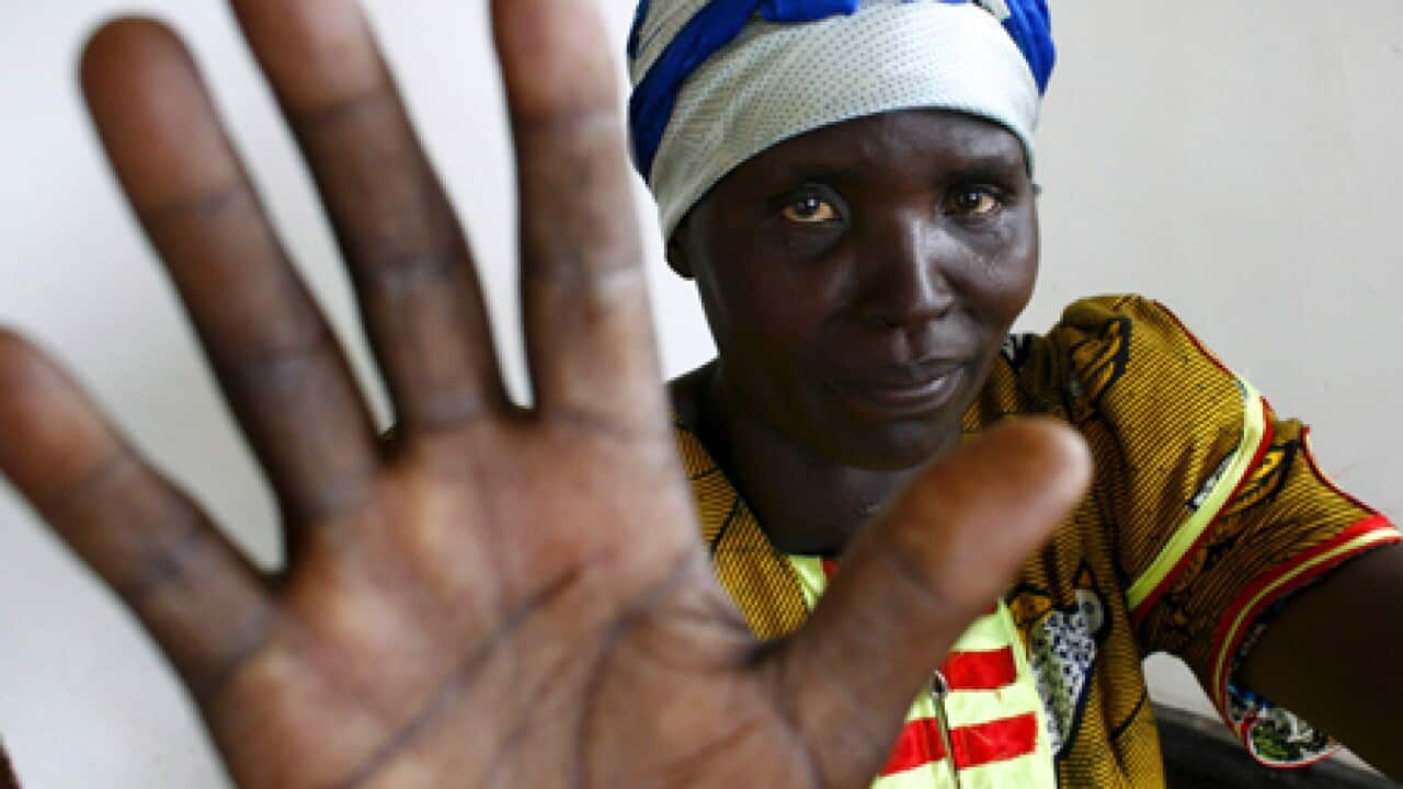 congo_rape_survivor_100908_B_epa_698185266