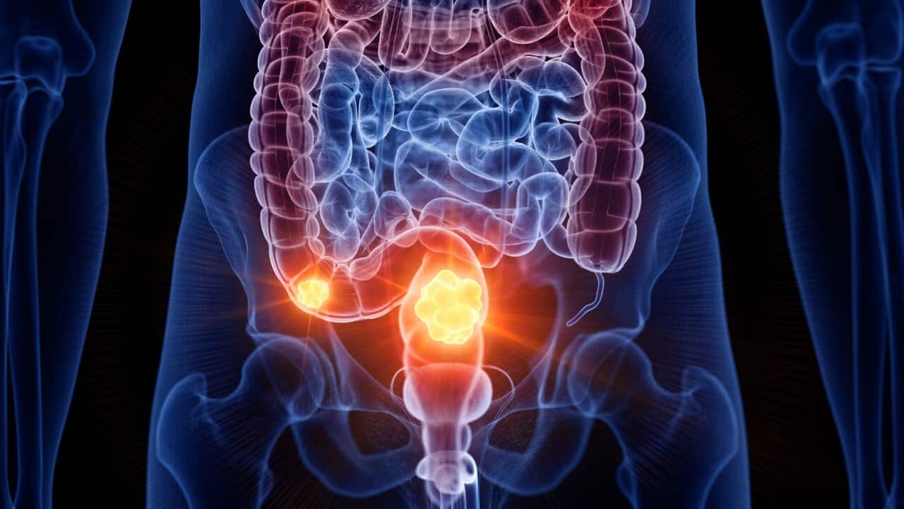 Bowel cancer awareness month