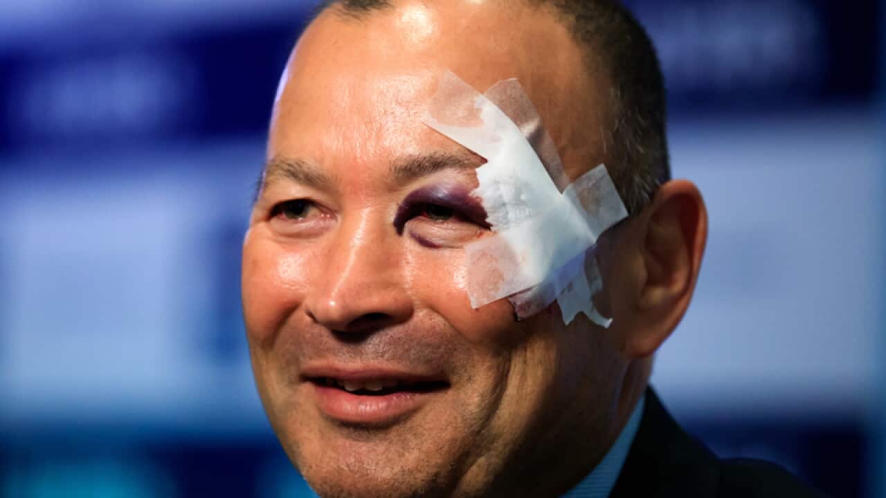 England head coach Eddie Jones