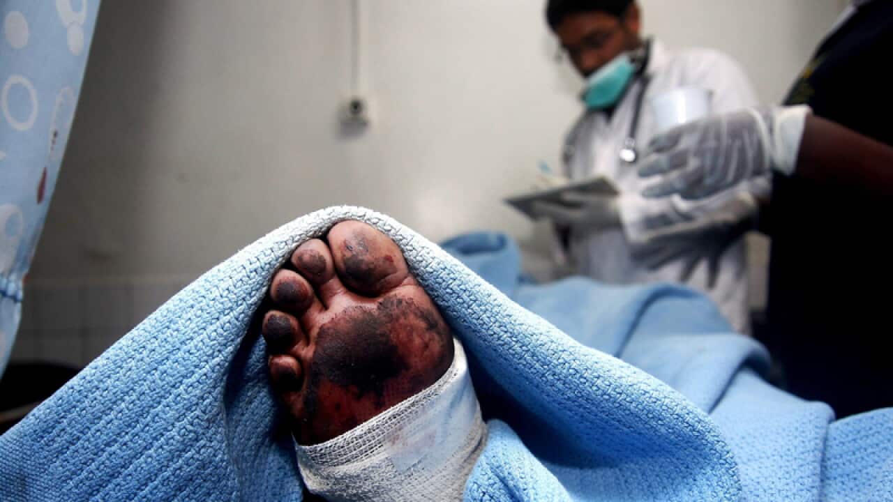 An injured at the Kenyatta National Hospital, Kenya
