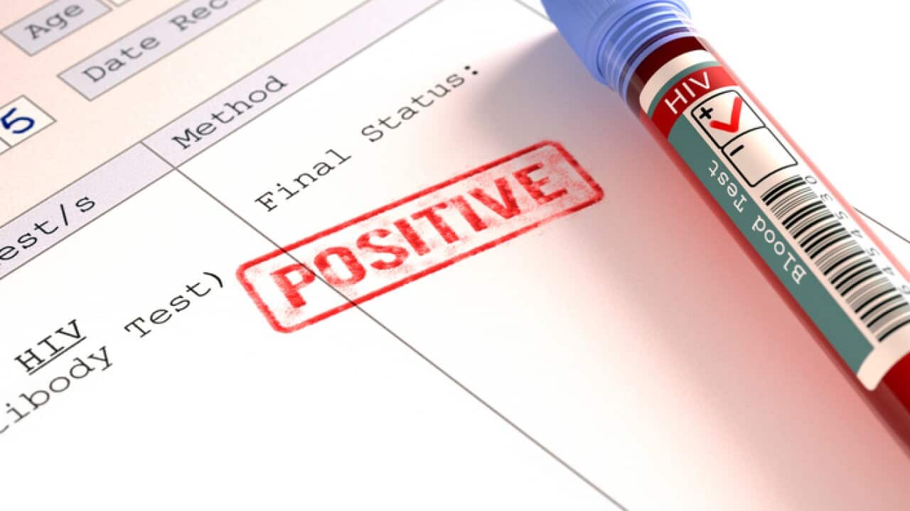 Positive HIV blood test, illustration