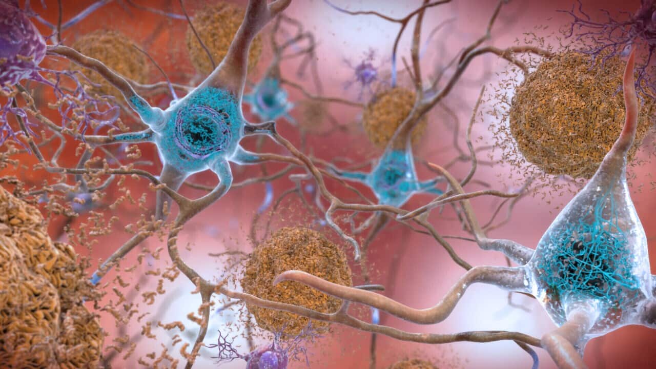 An illustration of brain synapses.
