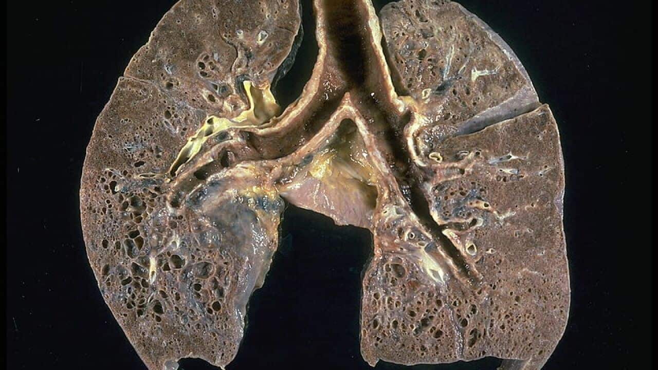 Image for read more article 'READ MORE'