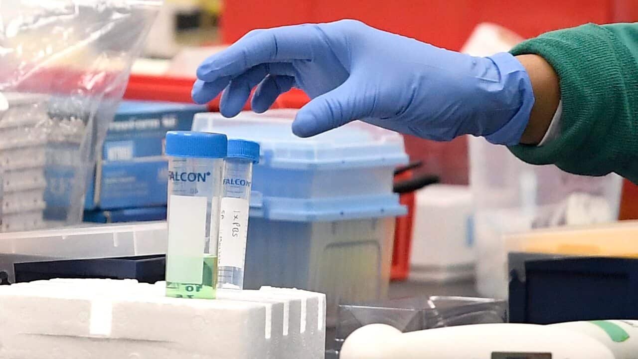 Researchers around the globe are racing to find a vaccine for COVID-19.