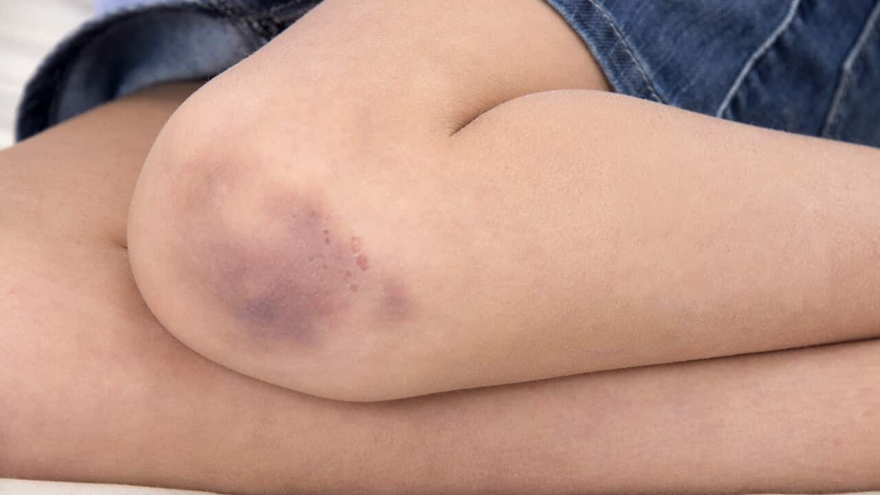 Image for read more article ''