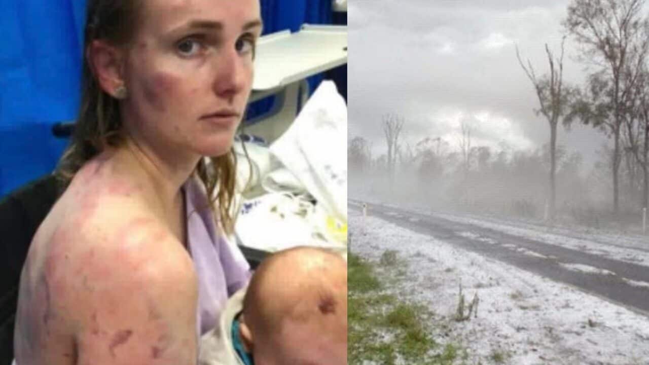 Fiona Simpson was left battered and bruised by the huge hail that covered parts of southeast Queensland.