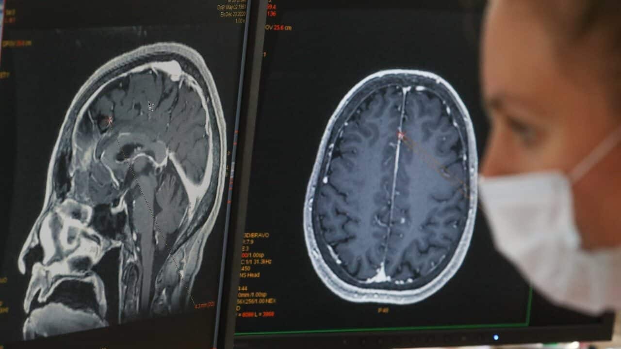 A technician looking at an MRI scan of a human brain