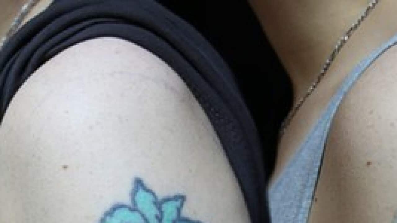 Tattoo removal laser