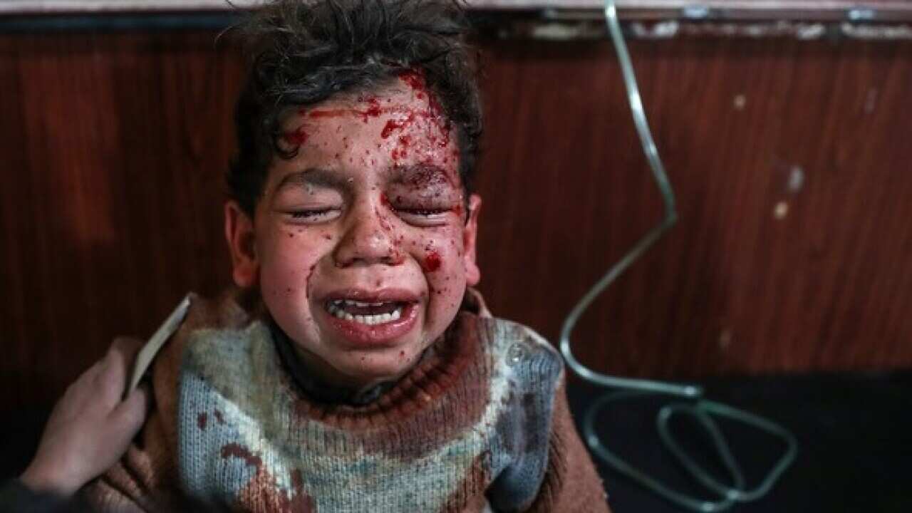 An injured child in Douma, eastern Ghouta, Syria