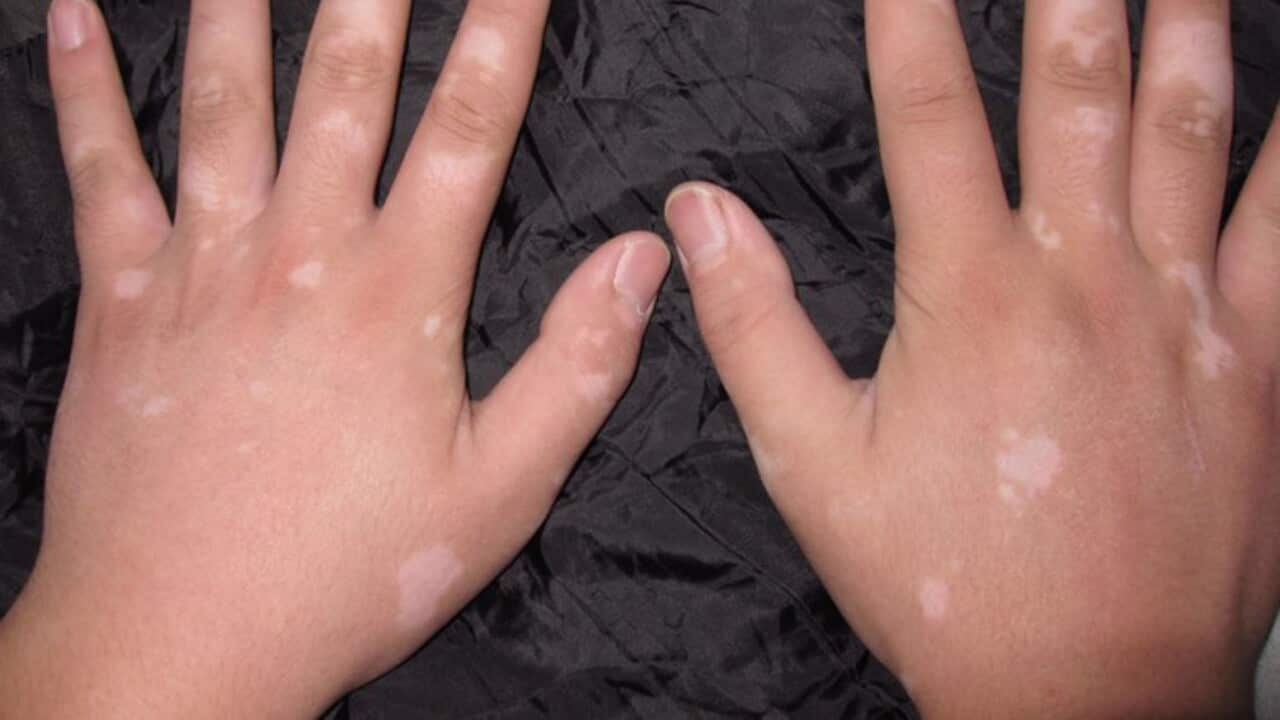 Image for read more article ''