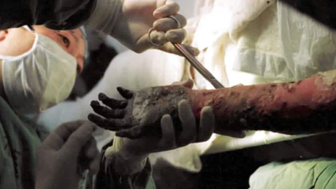 skin_graft_100615_B_aap_217399597