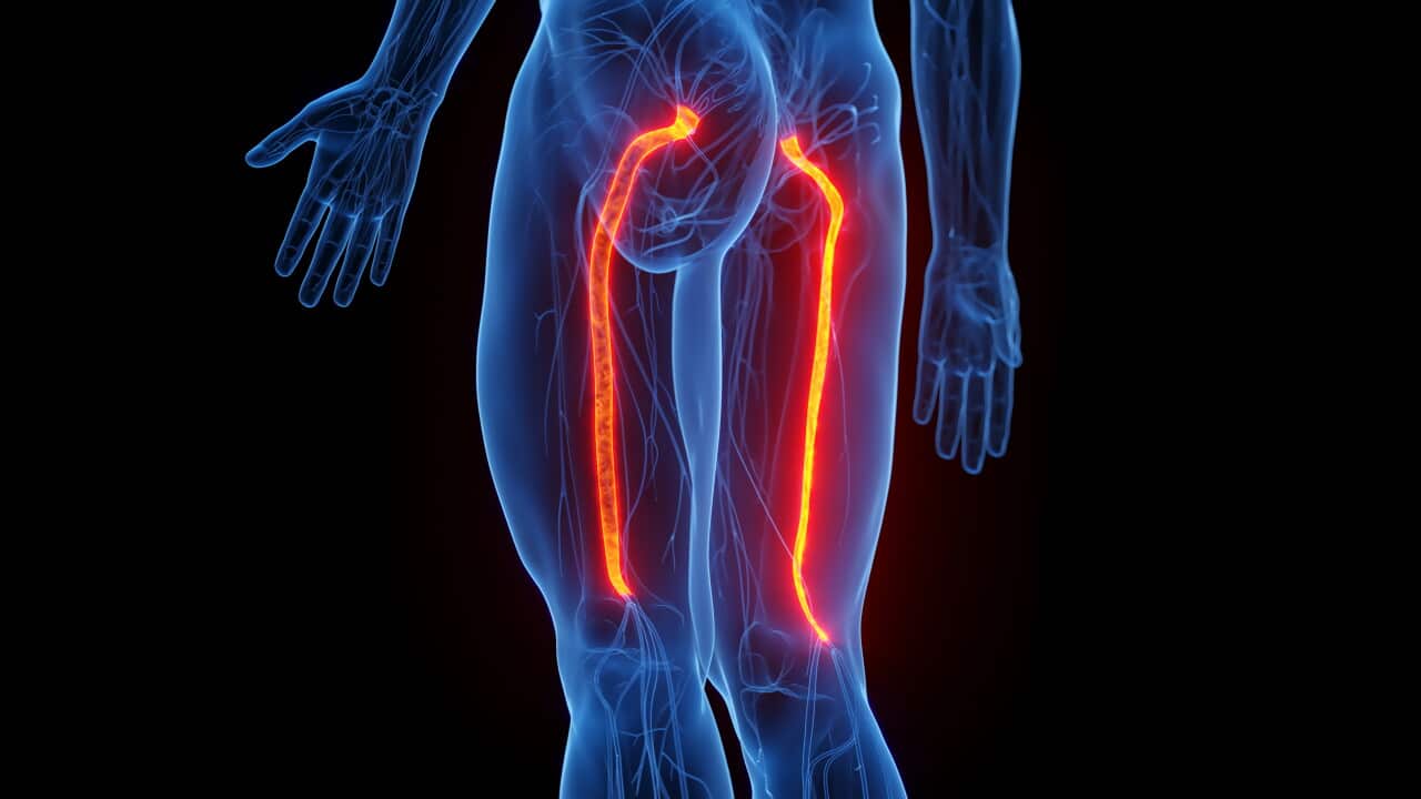 Sciatic nerves, illustration