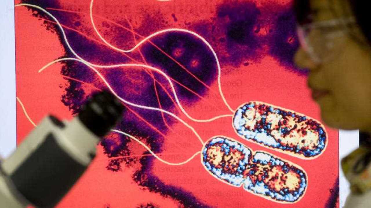 Infectious disease researchers study Superbugs in a laboratory at the University of Queensland Centre for Clinical Research