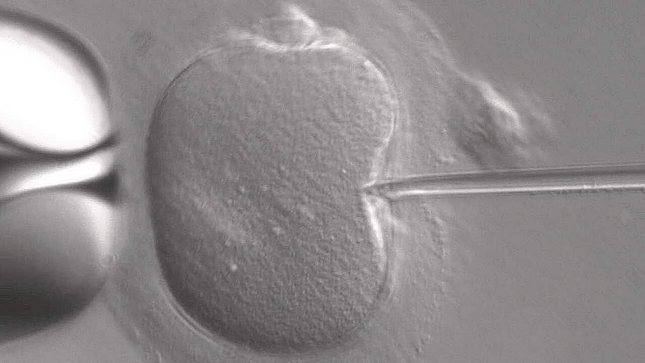 Image for read more article 'ВАМ ТАКЖЕ БУДЕТ ИНТЕРЕСНО:'