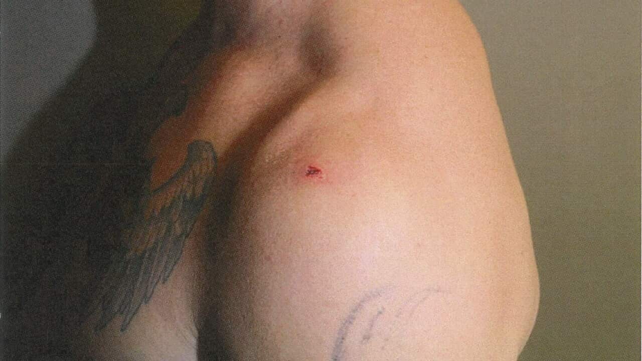 'Axe incident' examined as NT court releases images of Rolfe injury ...