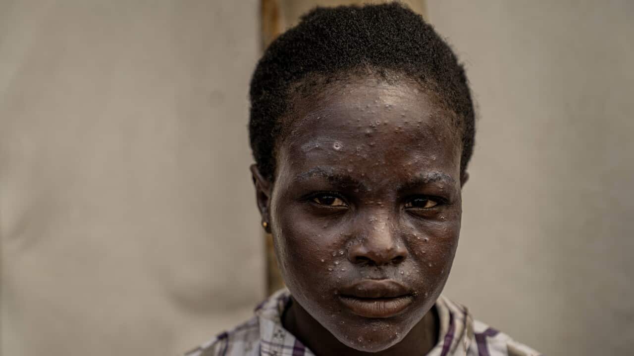 Image for read more article 'Más información:'