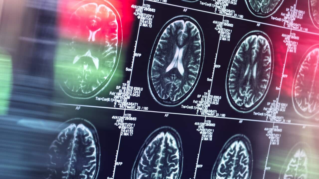 Human brain scan in neurology clinic