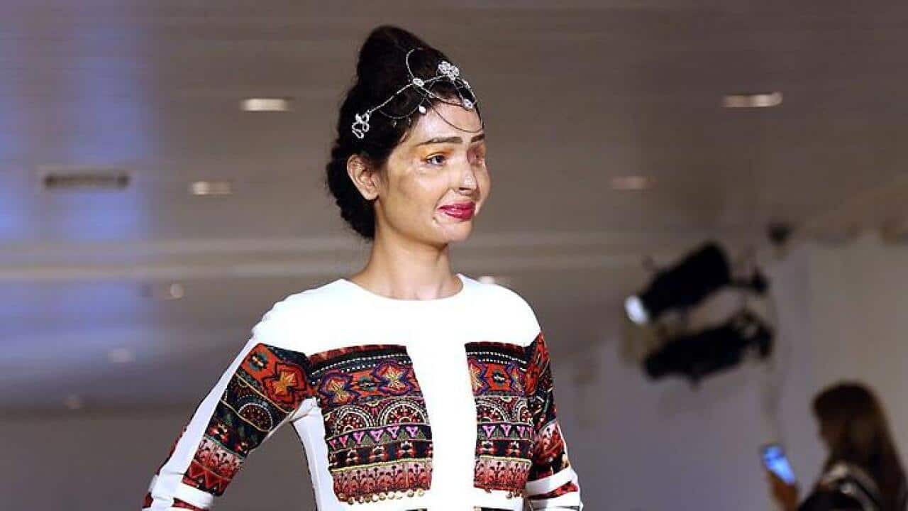 Acid attack survivor Reshma Bano of India walks the runway during the FTL Moda presentation at New York Fashion Week in New York, on September 8, 2016. / AFP / TREVOR COLLENS (Photo credit should read TREVOR COLLENS/AFP/Getty Images)