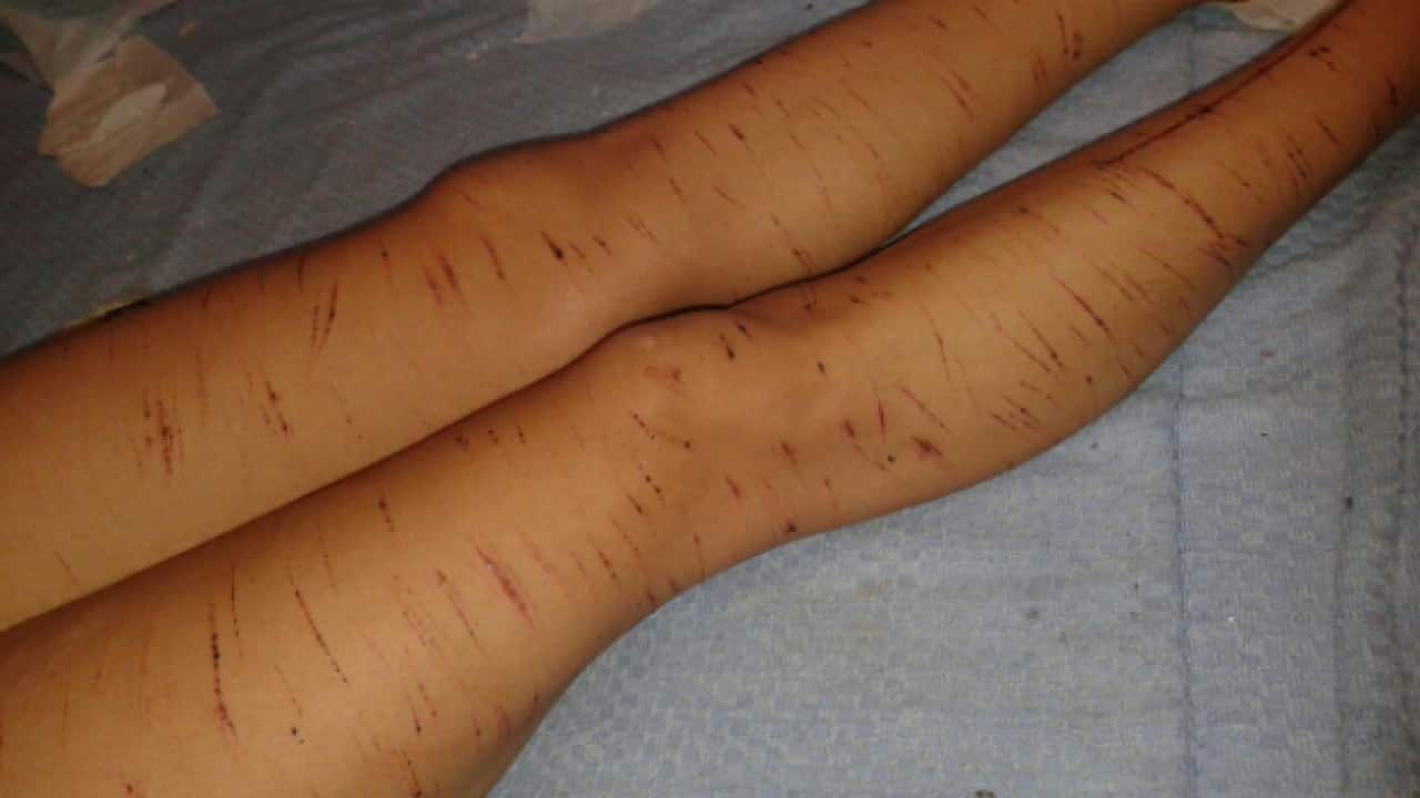 Amnesty International Report: Island of Despair