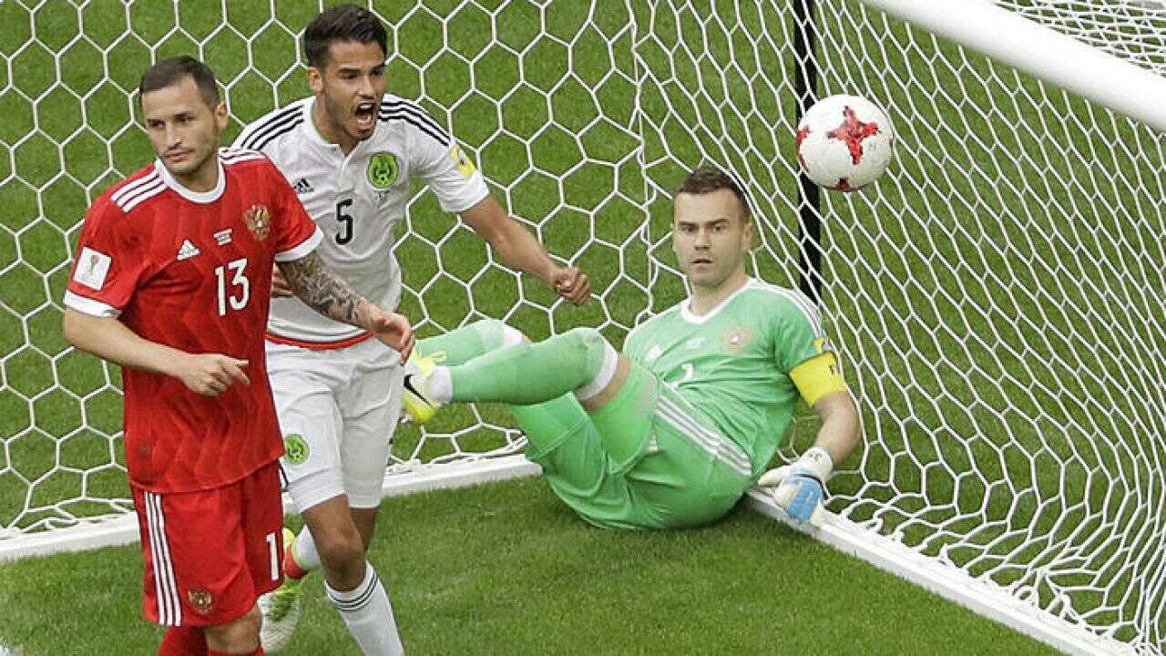 Igor Akinfeev's mistake proved costly