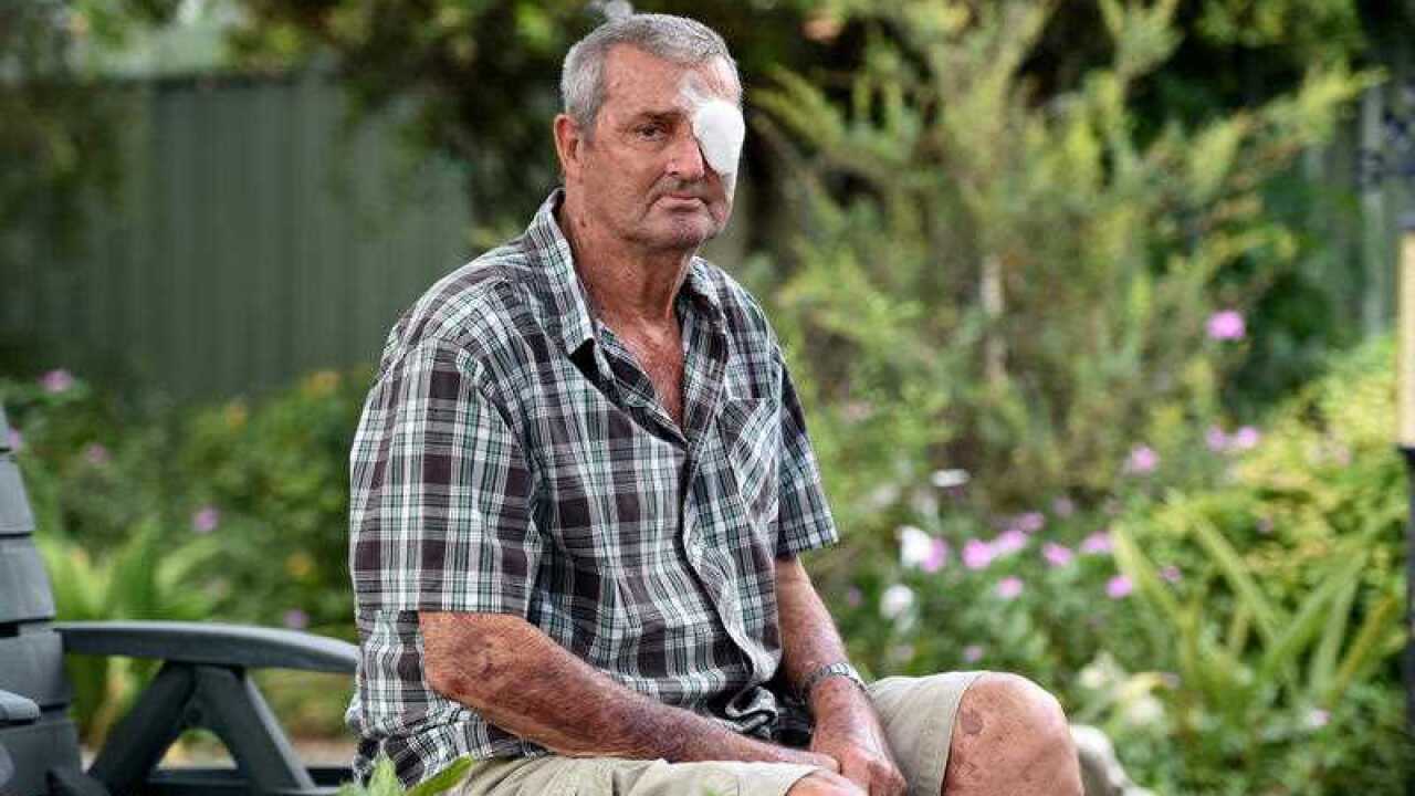 Black Lung disease sufferer Percy Verrall 