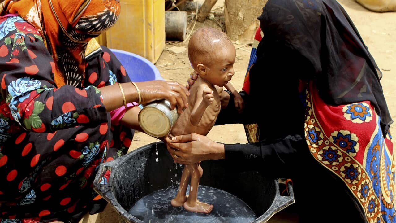 A severely malnourished infant is bathed in a bucket in Aslam, Hajjah, Yemen.