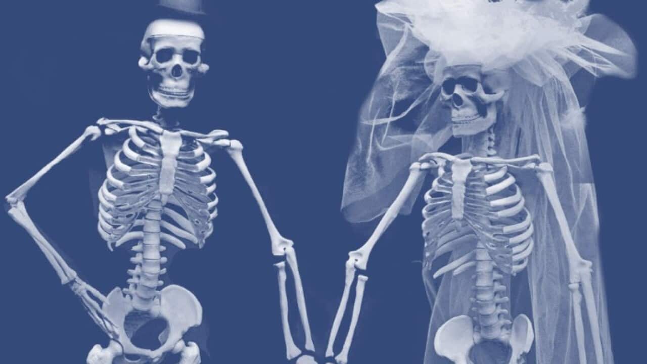 Groom skeleton