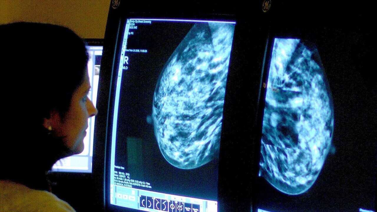 A mammogram is analysed