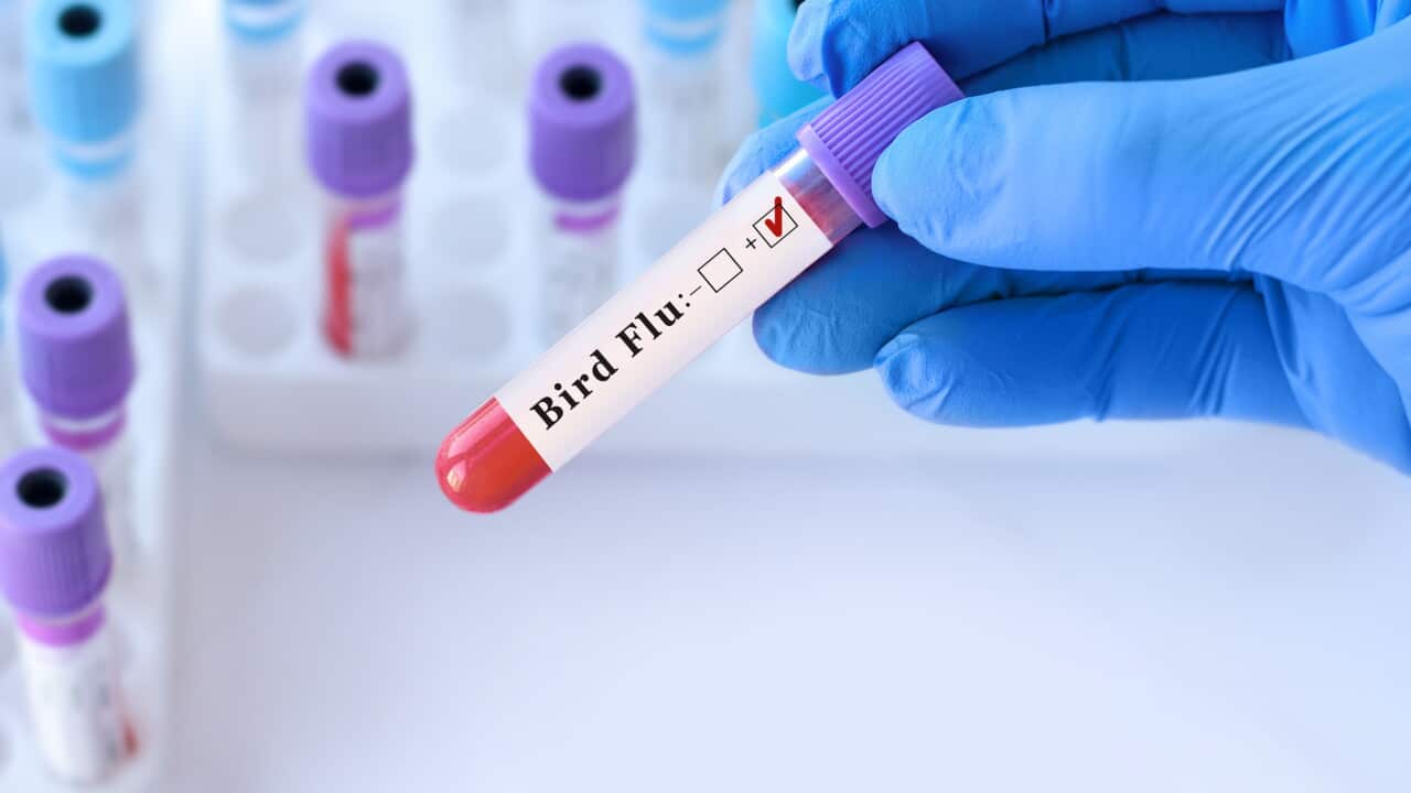 Doctor holding a test blood sample tube positive with Bird Flu test on the background of medical test tubes with analyzes.Banner.